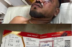 印航空难一名幸存者从残骸中走出，母公司为每名死者赔一千万卢比