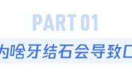 牙缝里的牙垢又臭又硬，教你这个小妙招，脏牙垢自动掉落