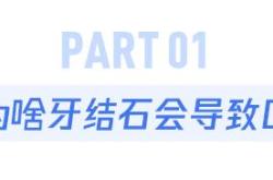 牙缝里的牙垢又臭又硬，教你这个小妙招，脏牙垢自动掉落